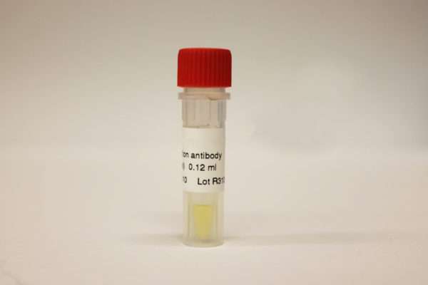 SARS-CoV-2 S1RBD-ACE2 Binding Assay Kit - Image 4