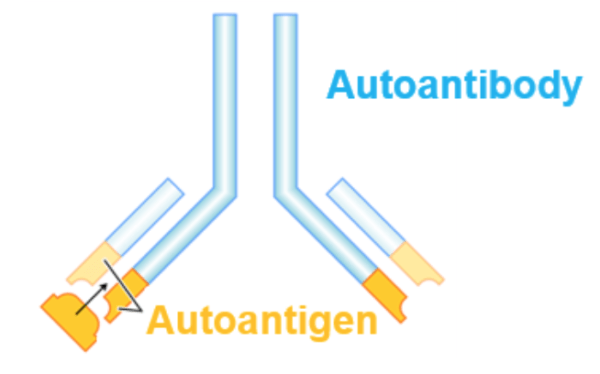 Histone H2A AutoAntigen